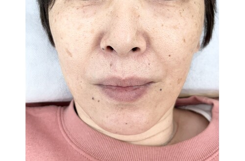 様々な薬剤の中から最適なものを選びます